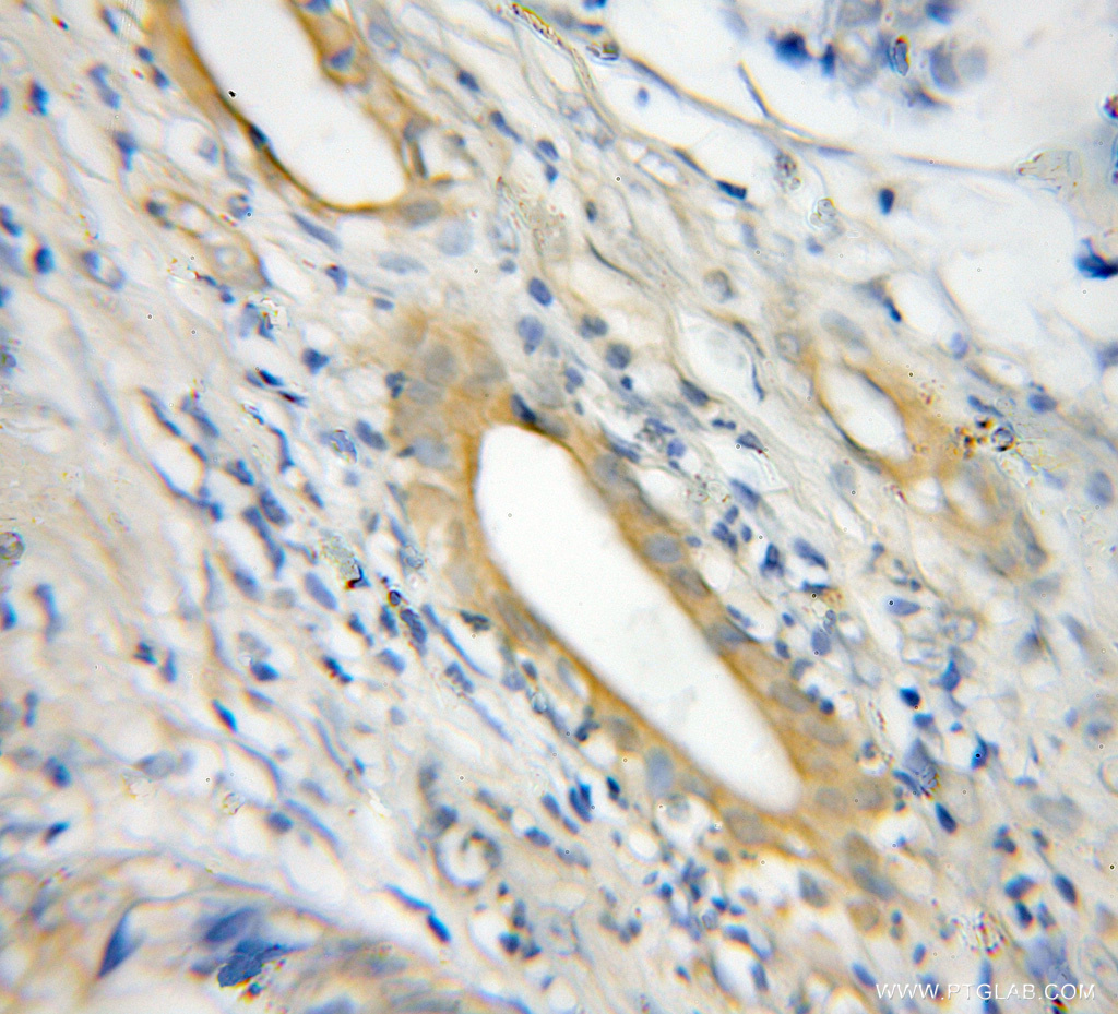 NLRP1 Polyclonal antibody