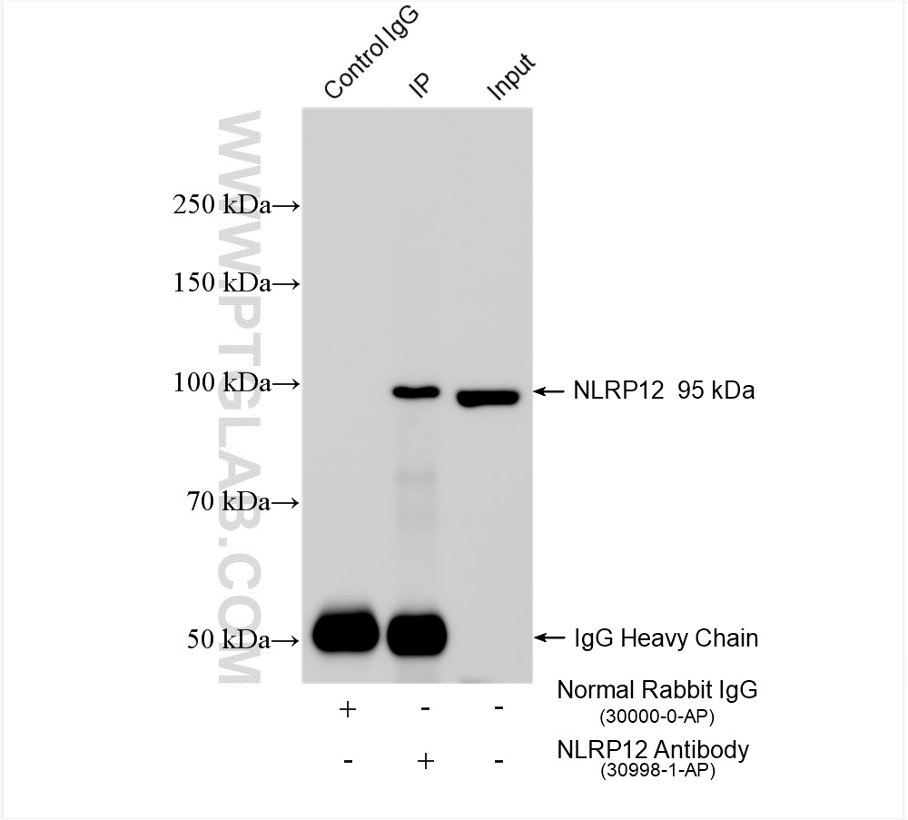 IP experiment of rat liver using 30998-1-AP (same clone as 30998-1-PBS)