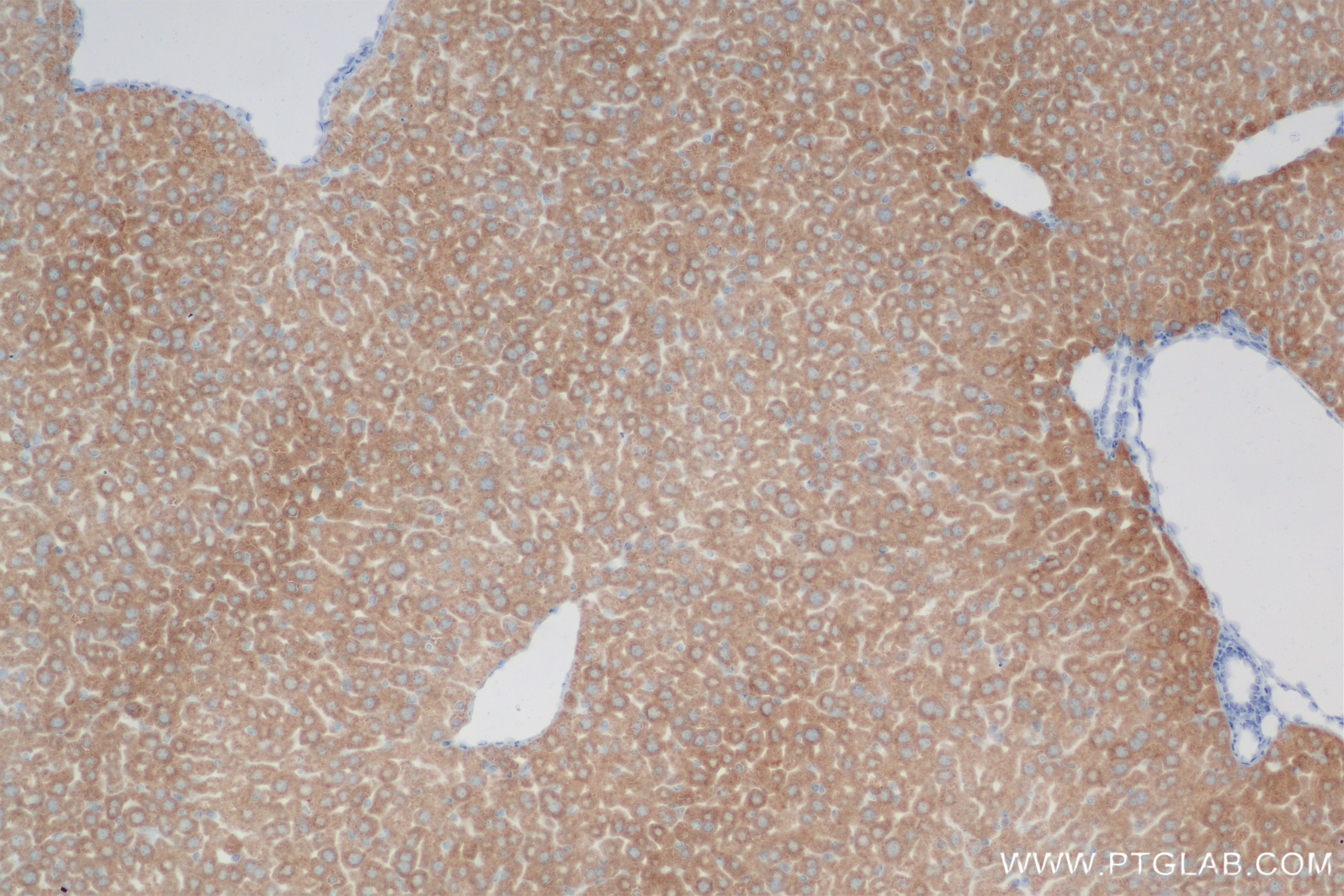 IHC staining of mouse liver using 83123-6-RR