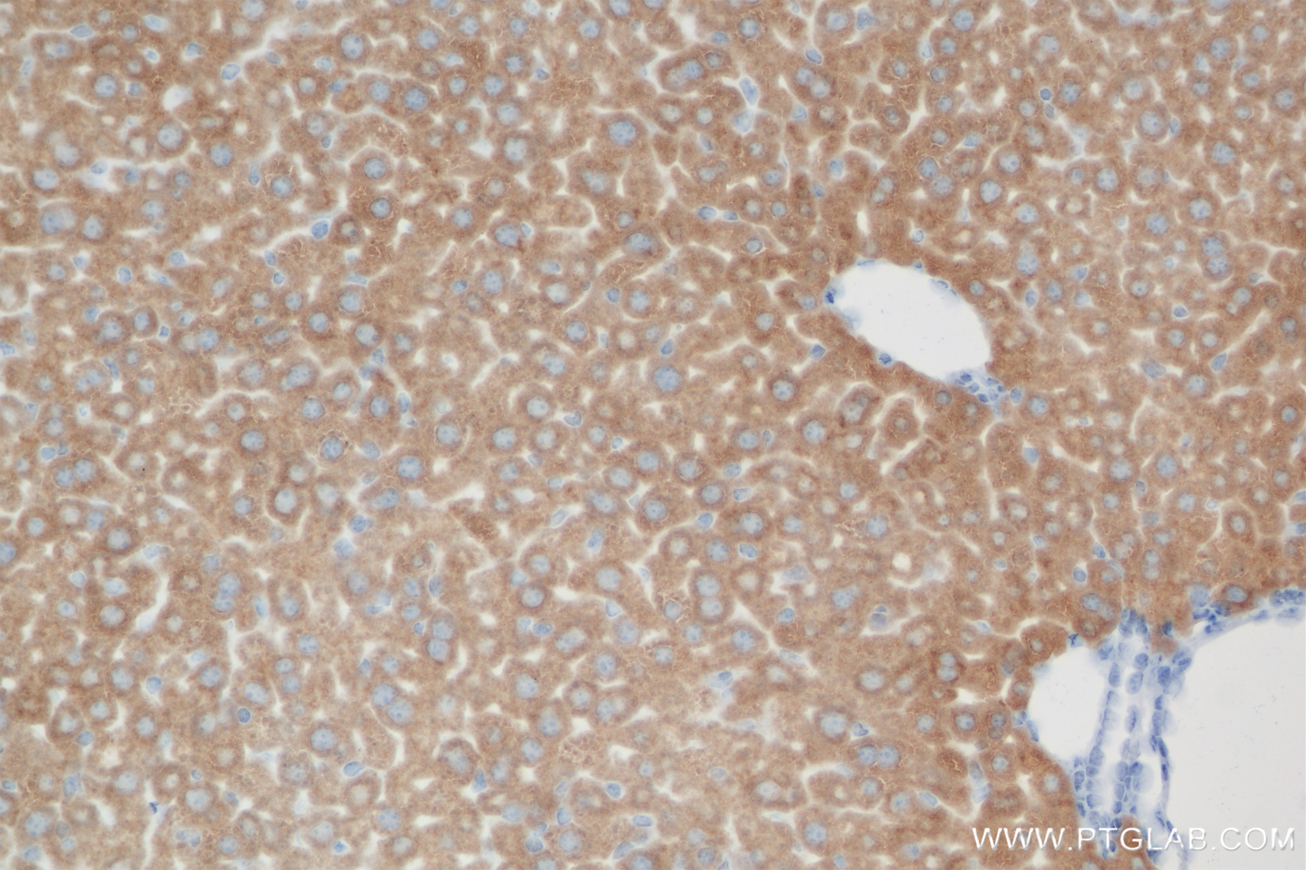 IHC staining of mouse liver using 83123-6-RR
