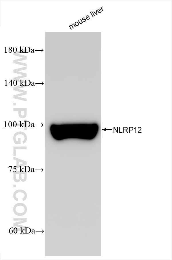 WB analysis using 83123-6-RR