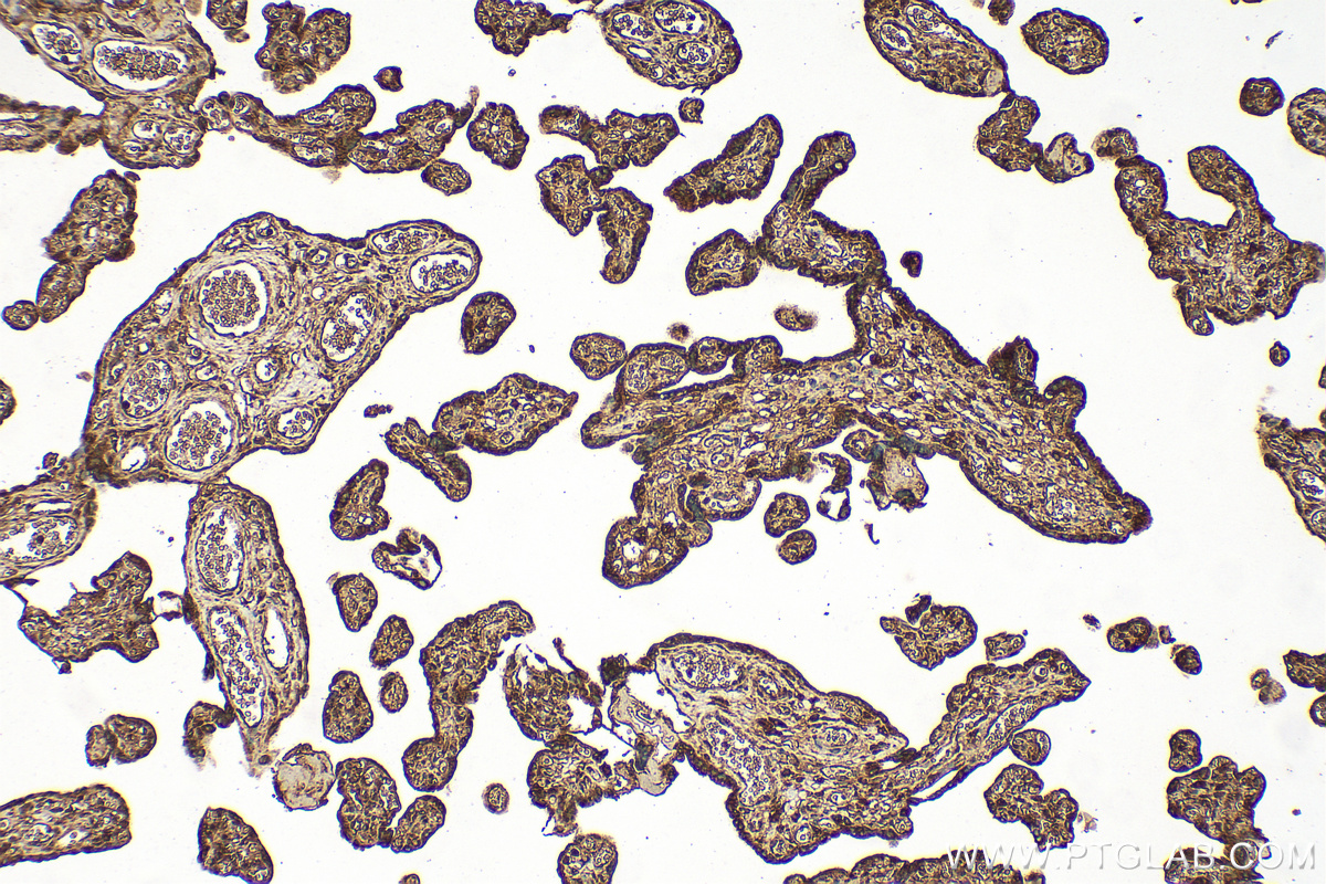 IHC staining of human placenta using 15182-1-AP