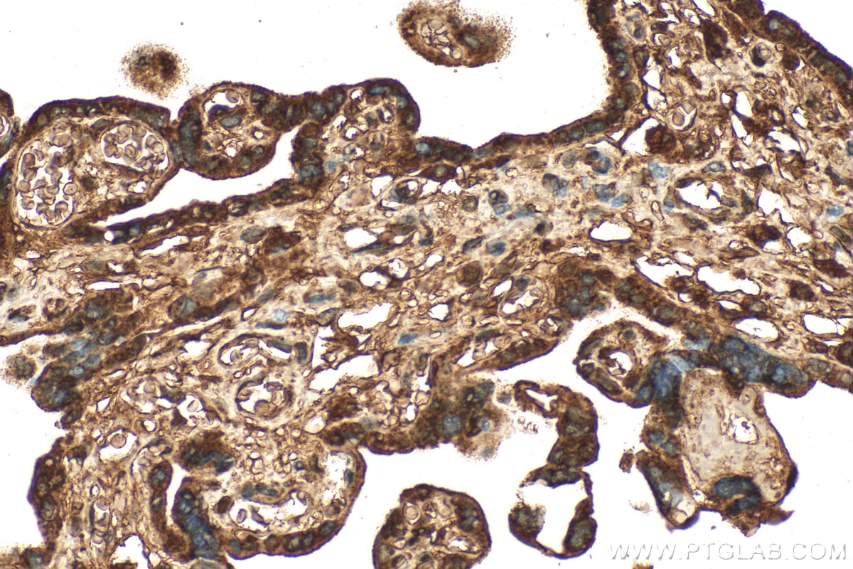IHC staining of human placenta using 15182-1-AP