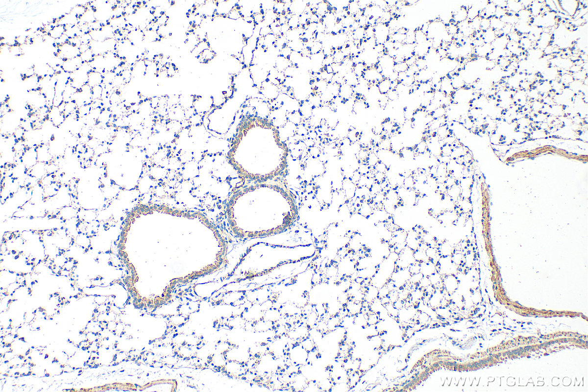 IHC staining of mouse lung using 32694-1-AP (same clone as 32694-1-PBS) IHC staining of mouse lung using 32694-1-AP (same clone as 32694-1-PBS)