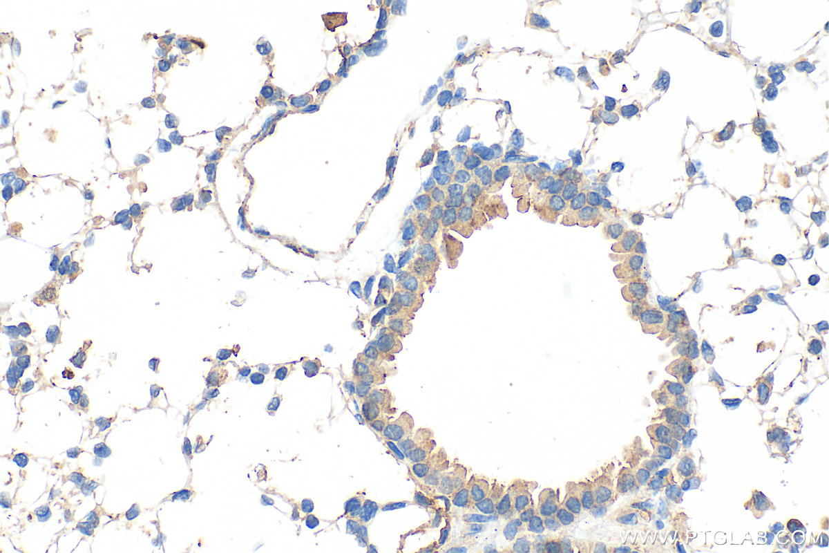 IHC staining of mouse lung using 32694-1-AP (same clone as 32694-1-PBS) IHC staining of mouse lung using 32694-1-AP (same clone as 32694-1-PBS)