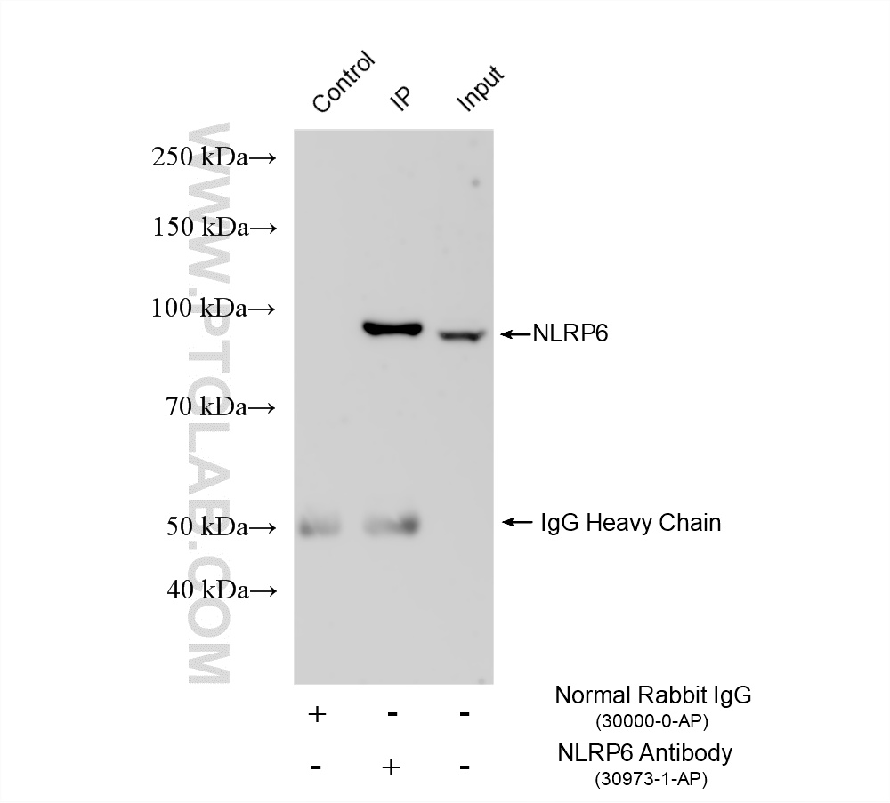 IP experiment of mouse colon using 30973-1-AP IP experiment of mouse colon using 30973-1-AP