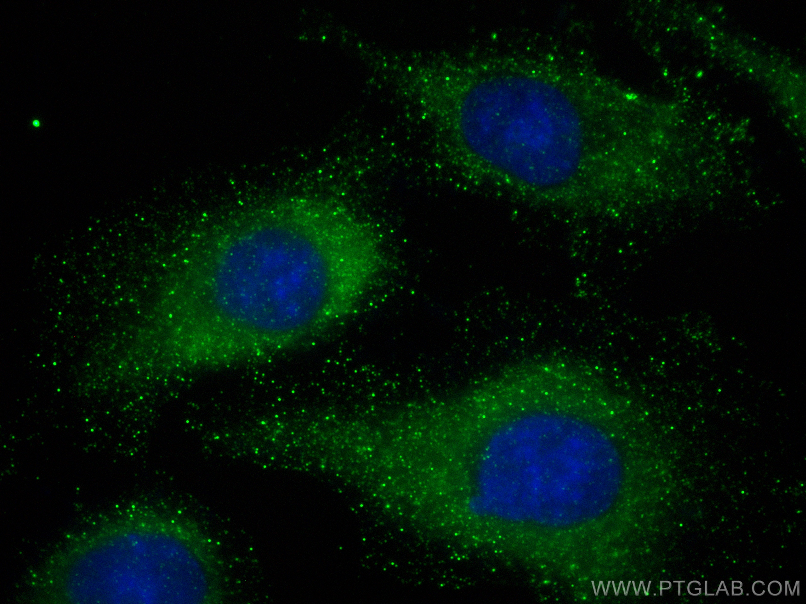 IF Staining of A549 using 83555-5-RR (same clone as 83555-5-PBS)