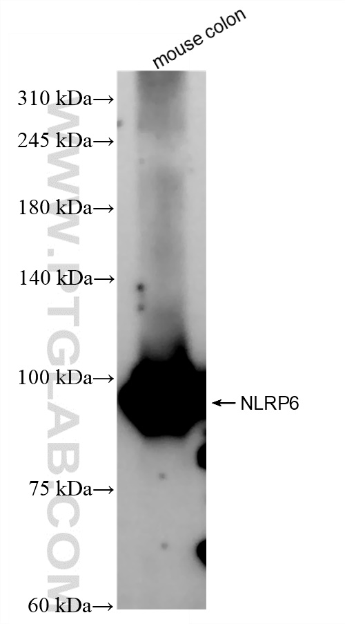 WB analysis of mouse colon using 83555-5-RR (same clone as 83555-5-PBS)