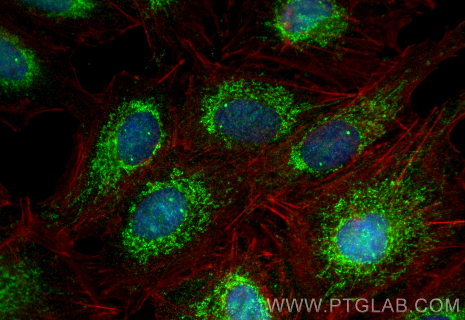 IF Staining of A549 using 17215-1-AP