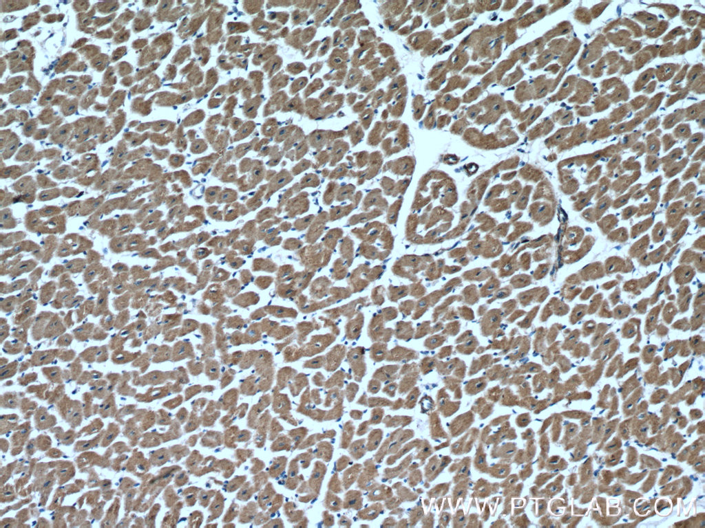 IHC staining of human heart using 17215-1-AP
