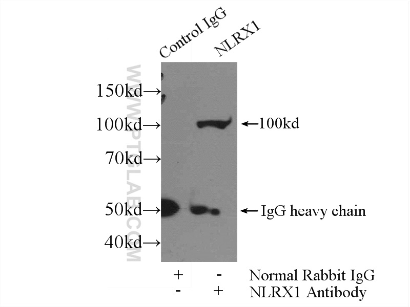 IP experiment of mouse heart using 17215-1-AP