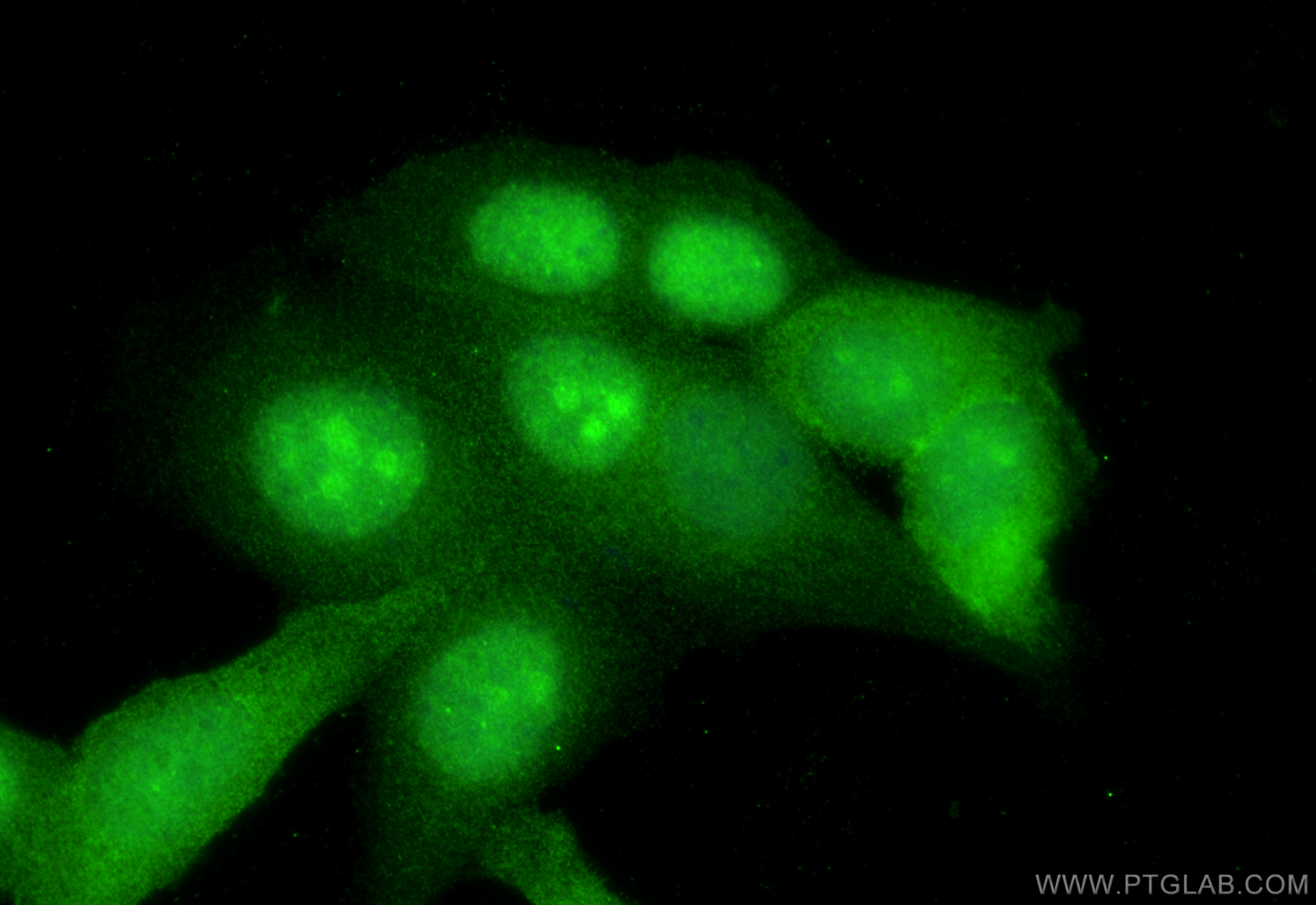 IF Staining of HepG2 using 16060-1-AP
