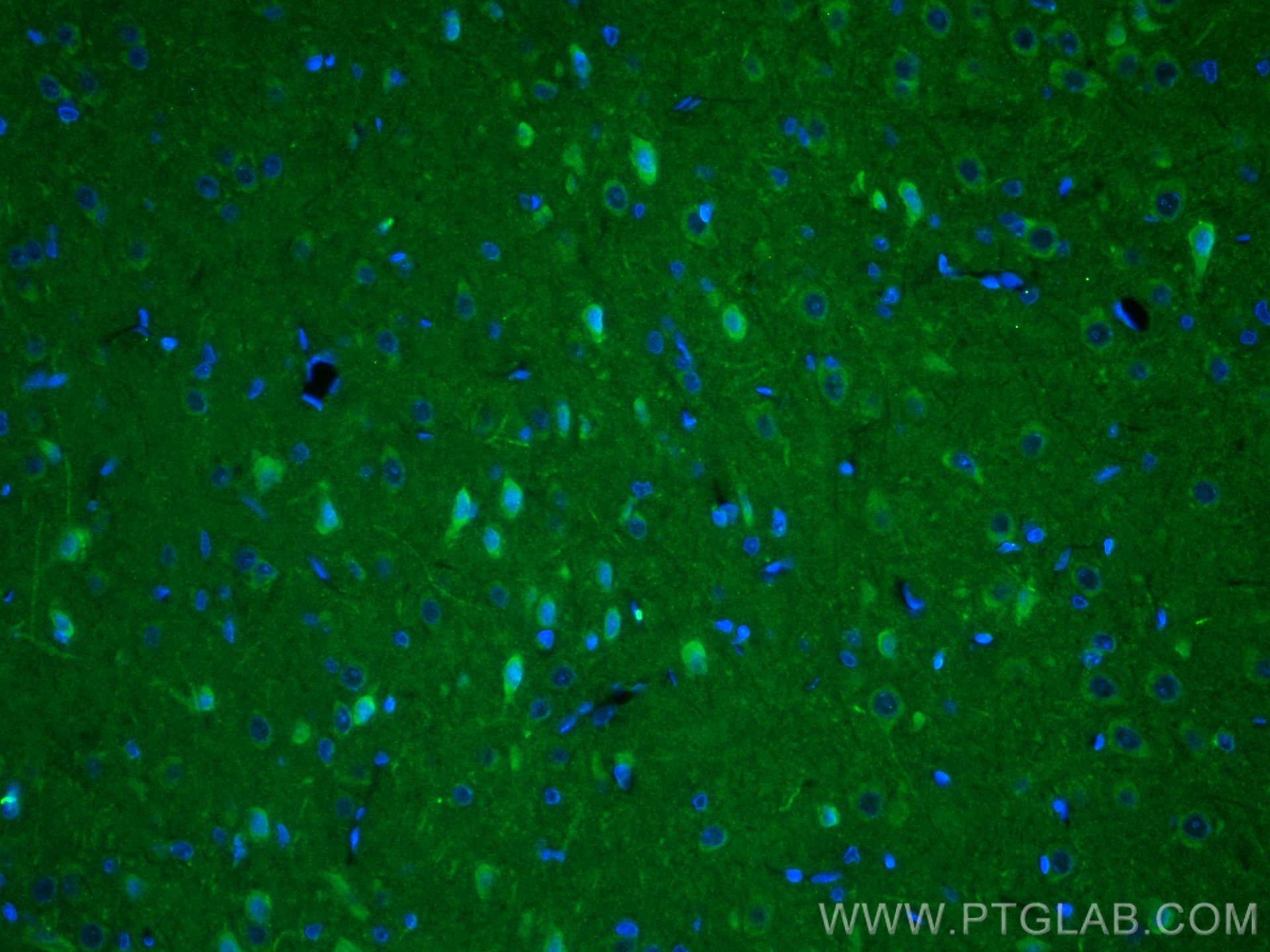 IF Staining of rat brain using 27232-1-AP
