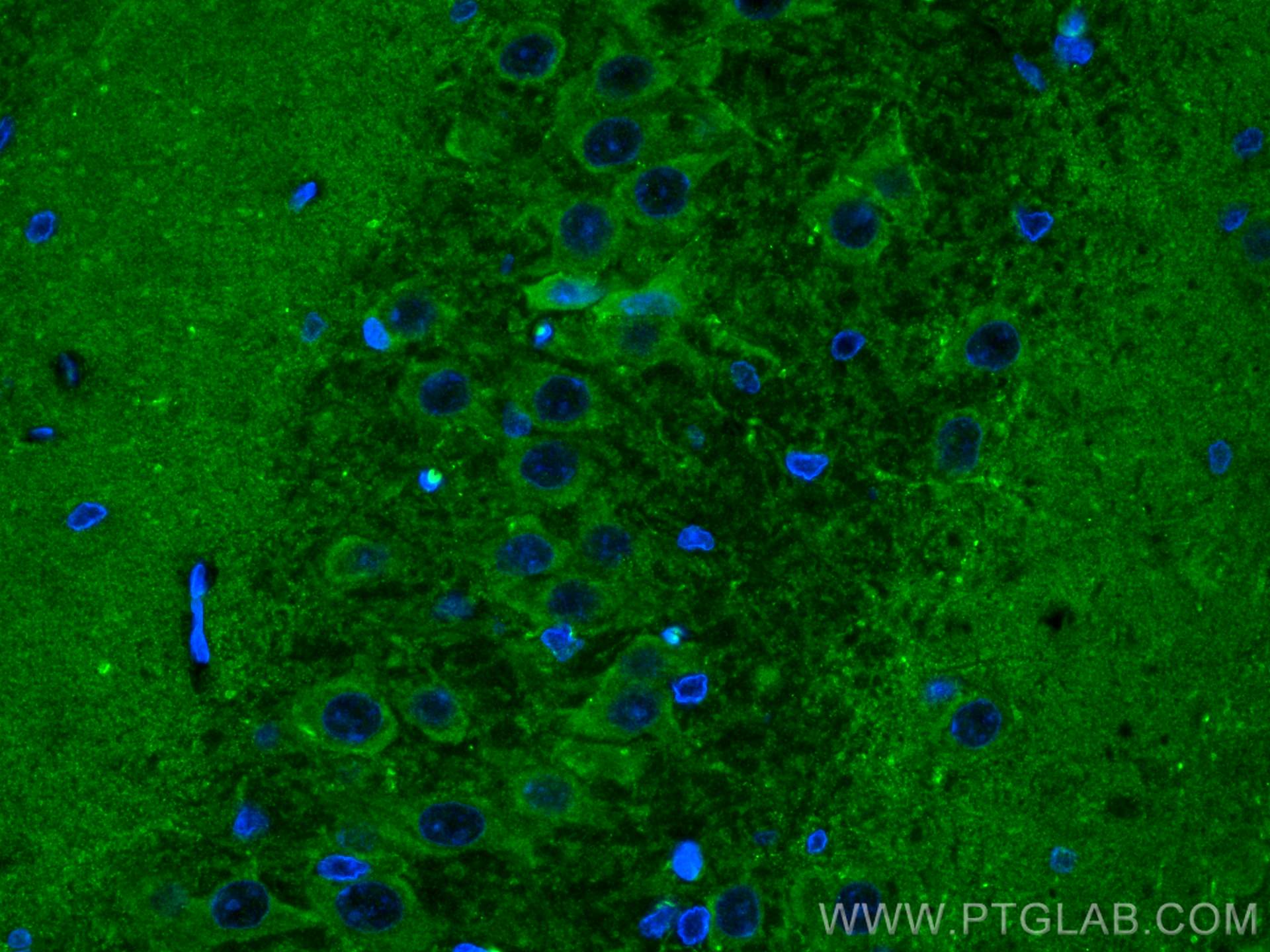 IF Staining of rat brain using 27232-1-AP