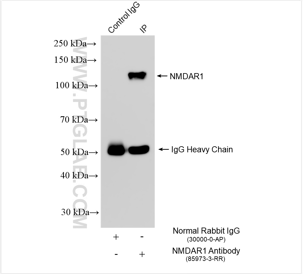 IP experiment of mouse brain using 85973-3-RR (same clone as 85973-3-PBS)