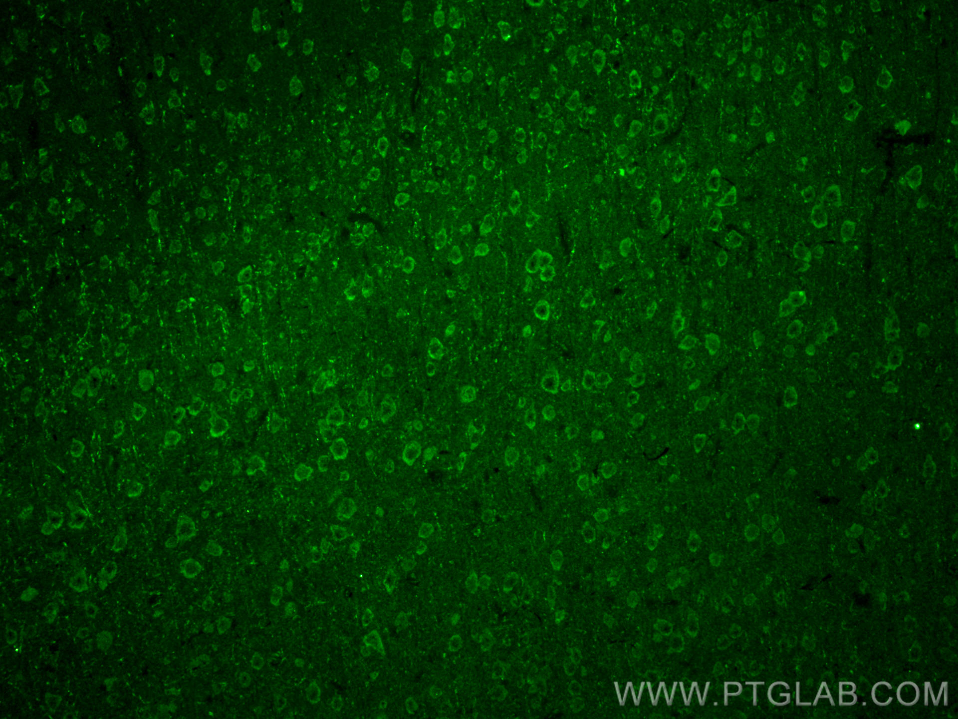IF Staining of mouse brain using CL488-67717