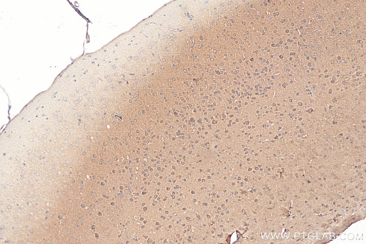 IHC staining of mouse brain using 28525-1-AP