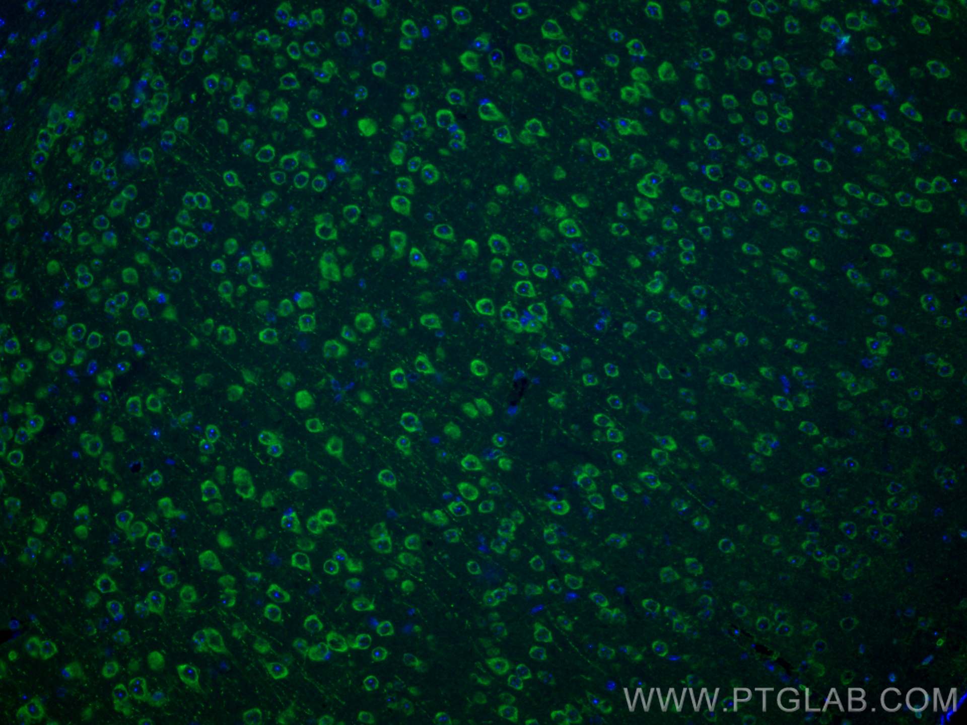 IF Staining of mouse brain using 28571-1-AP