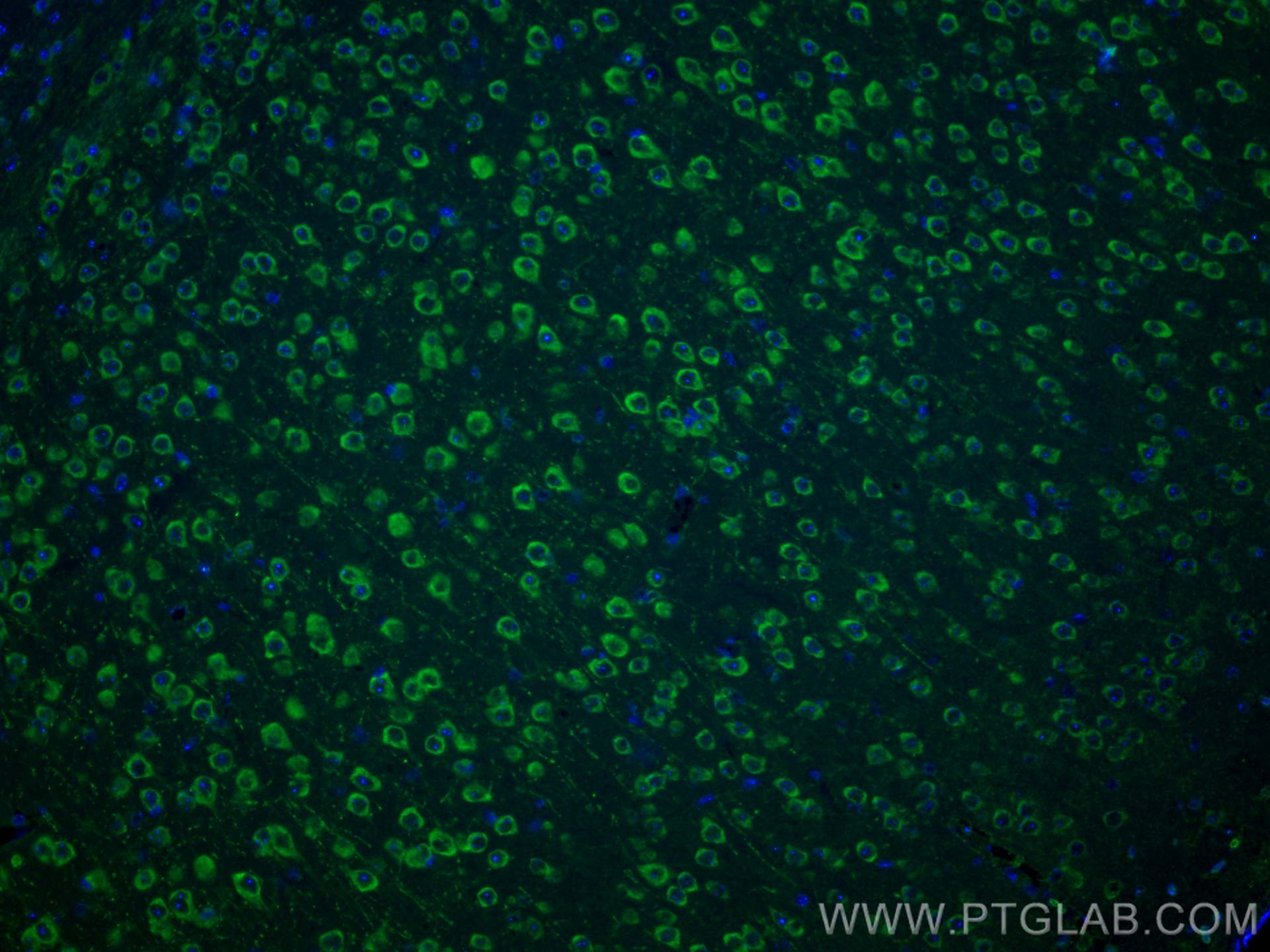 IF Staining of mouse brain using 28571-1-AP