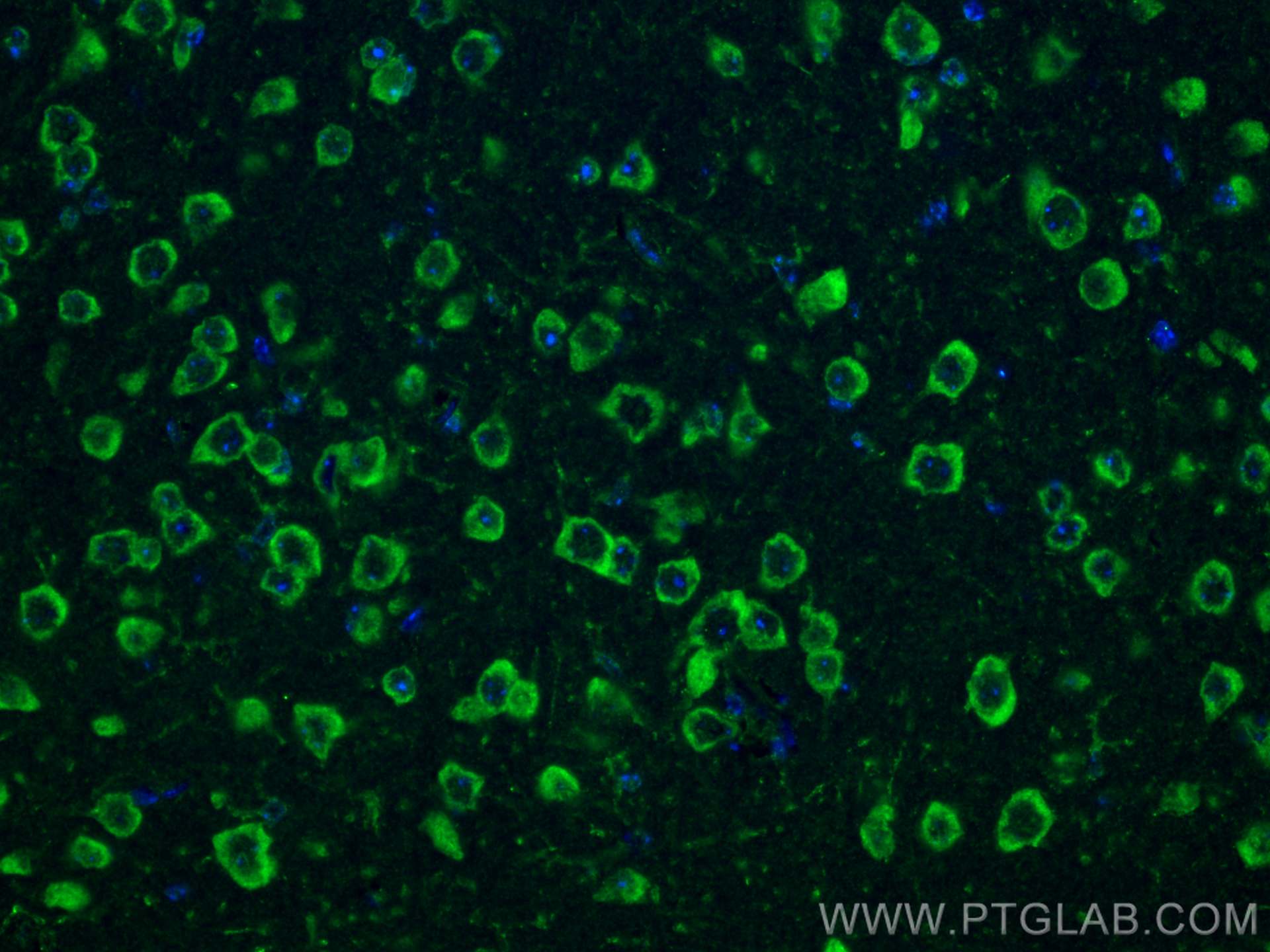 IF Staining of mouse brain using 28571-1-AP
