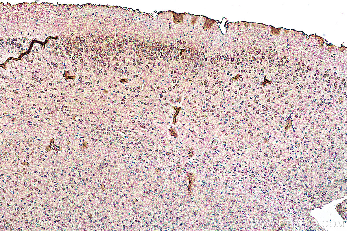 IHC staining of mouse brain using 28571-1-AP