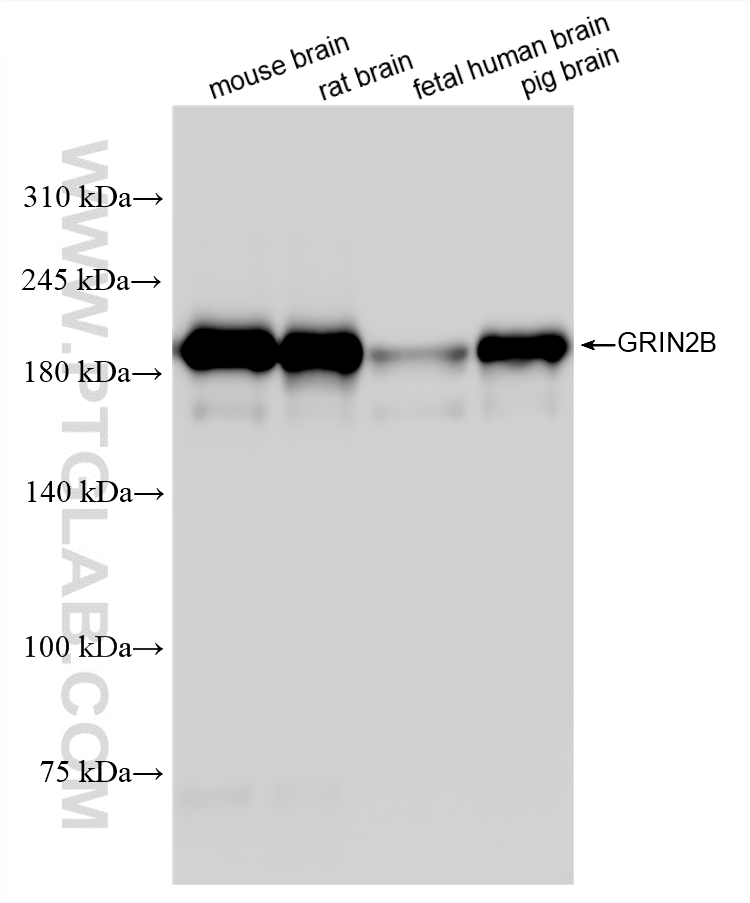 WB analysis using 88068-1-RR WB analysis using 88068-1-RR
