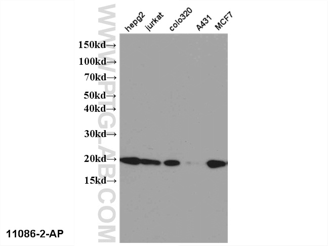 WB analysis of multi-cells using 11086-2-AP