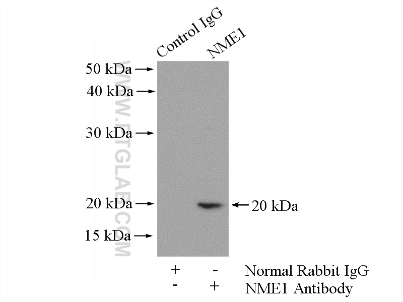 IP experiment of A549 using 11086-2-AP