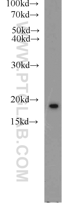 WB analysis of HeLa using 11086-2-AP