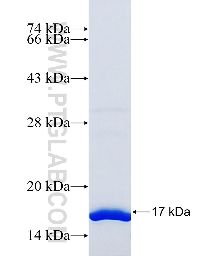 NME1-NME2 fusion protein Ag37879 SDS-PAGE NME1-NME2 fusion protein Ag37879 SDS-PAGE