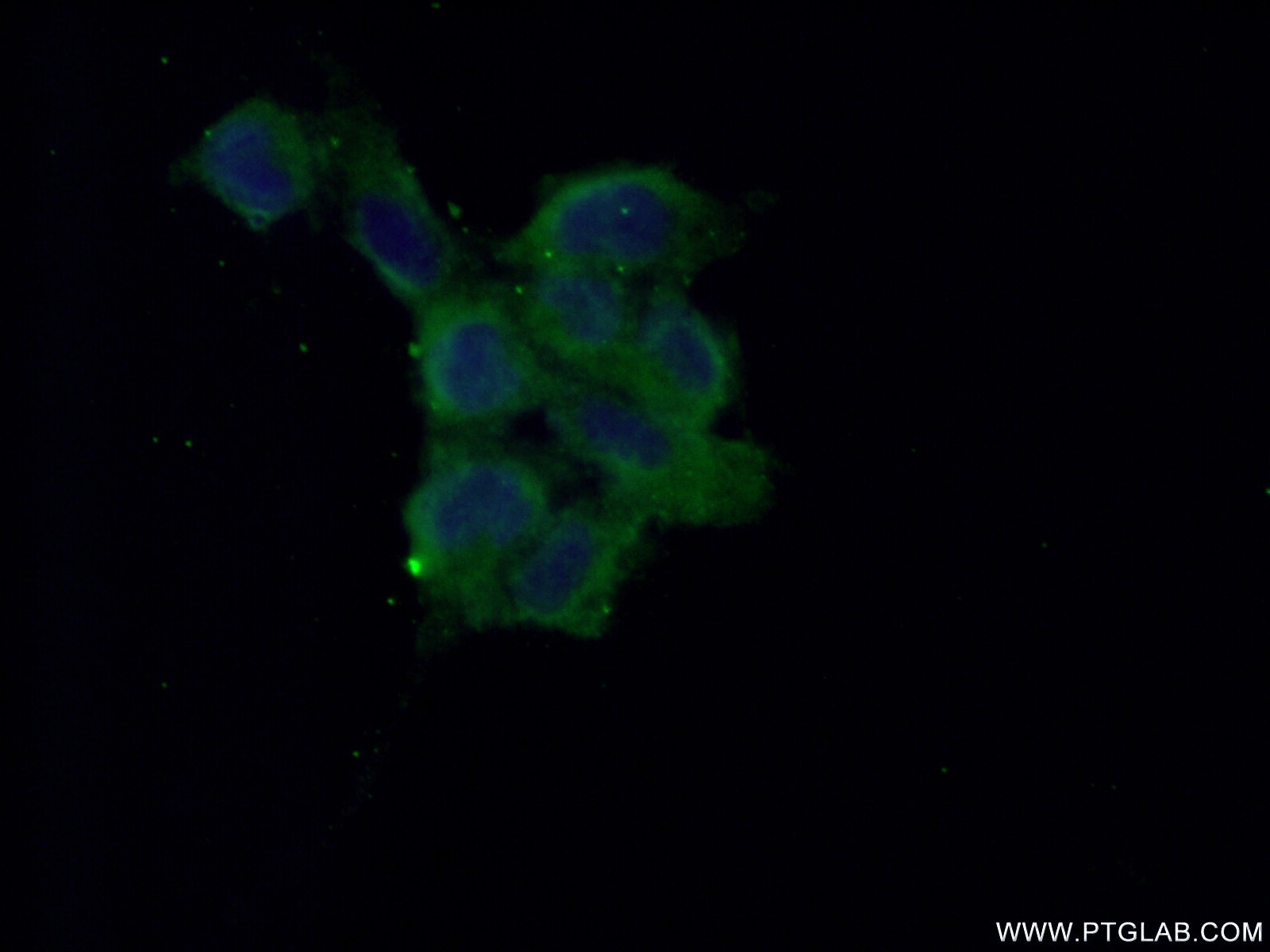 IF Staining of HEK-293 using 20493-1-AP (same clone as 20493-1-PBS)