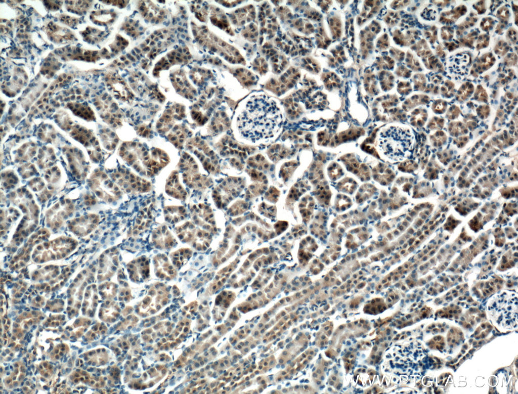IHC staining of mouse kidney using 20493-1-AP (same clone as 20493-1-PBS)