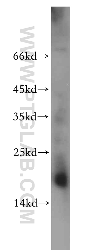 WB analysis of mouse kidney using 20493-1-AP (same clone as 20493-1-PBS)