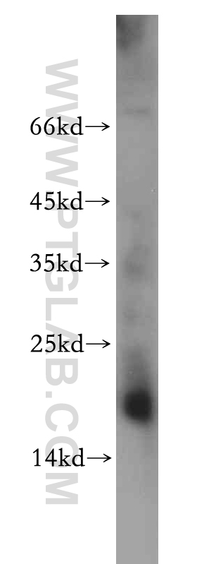 WB analysis of mouse kidney using 20493-1-AP