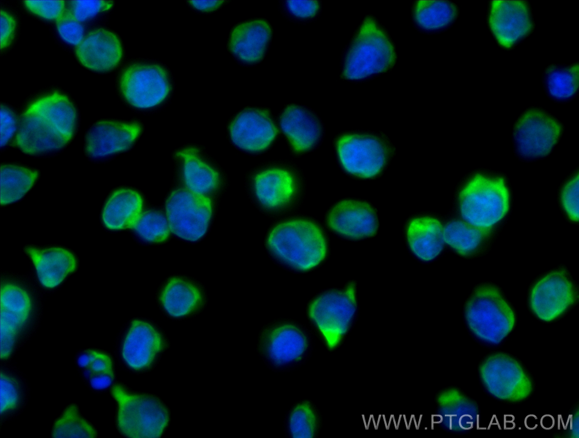Immunofluorescent analysis of (4% PFA) fixed Jurkat cells using CoraLite® Plus 488 NME2 antibody (CL488-85074-4, Clone: 242698C3 ) at dilution of 1:200. IF Staining of Jurkat using CL488-85074-4