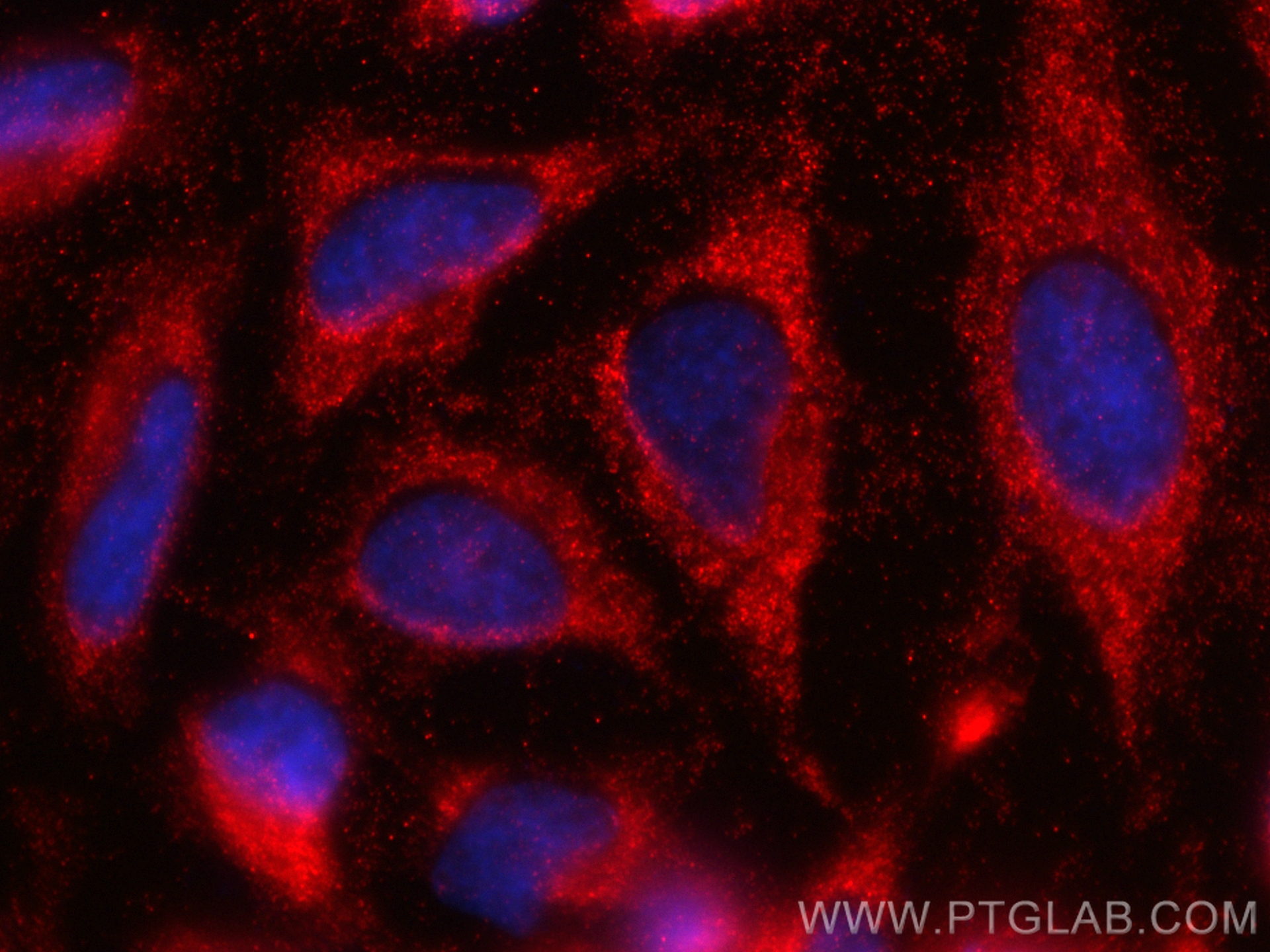 IF Staining of HeLa using 84278-5-RR