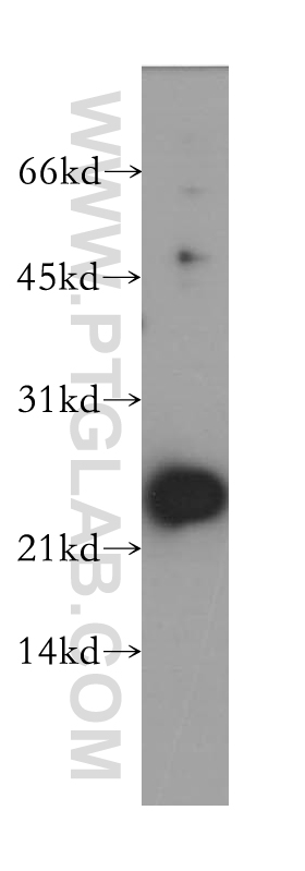 WB analysis of mouse testis using 12923-1-AP