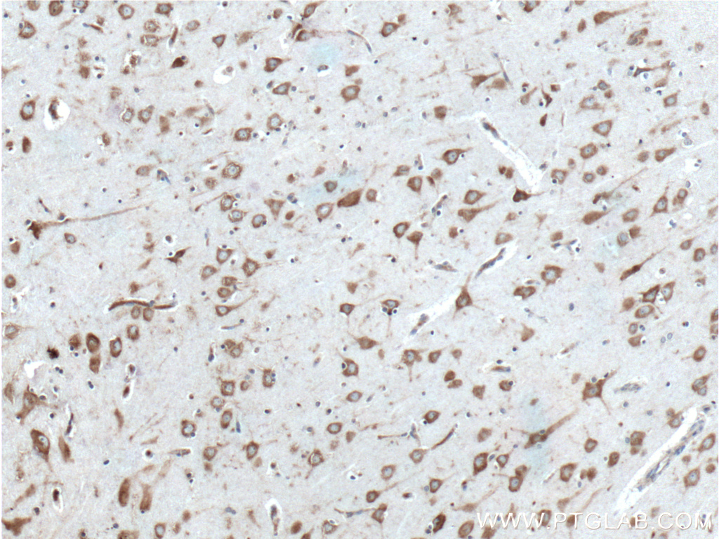 IHC staining of human brain using 26449-1-AP