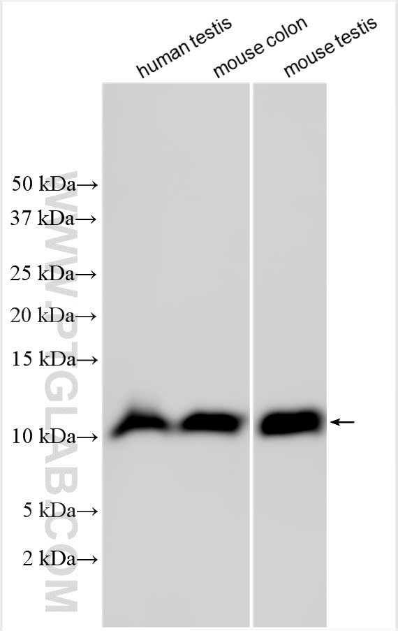 WB analysis using 25102-1-AP