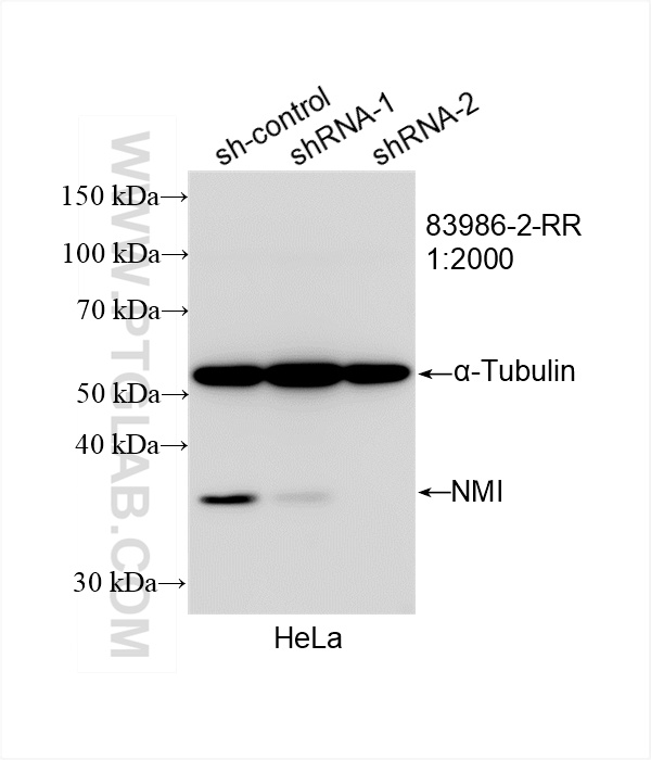 WB analysis of HeLa using 83986-2-RR (same clone as 83986-2-PBS)