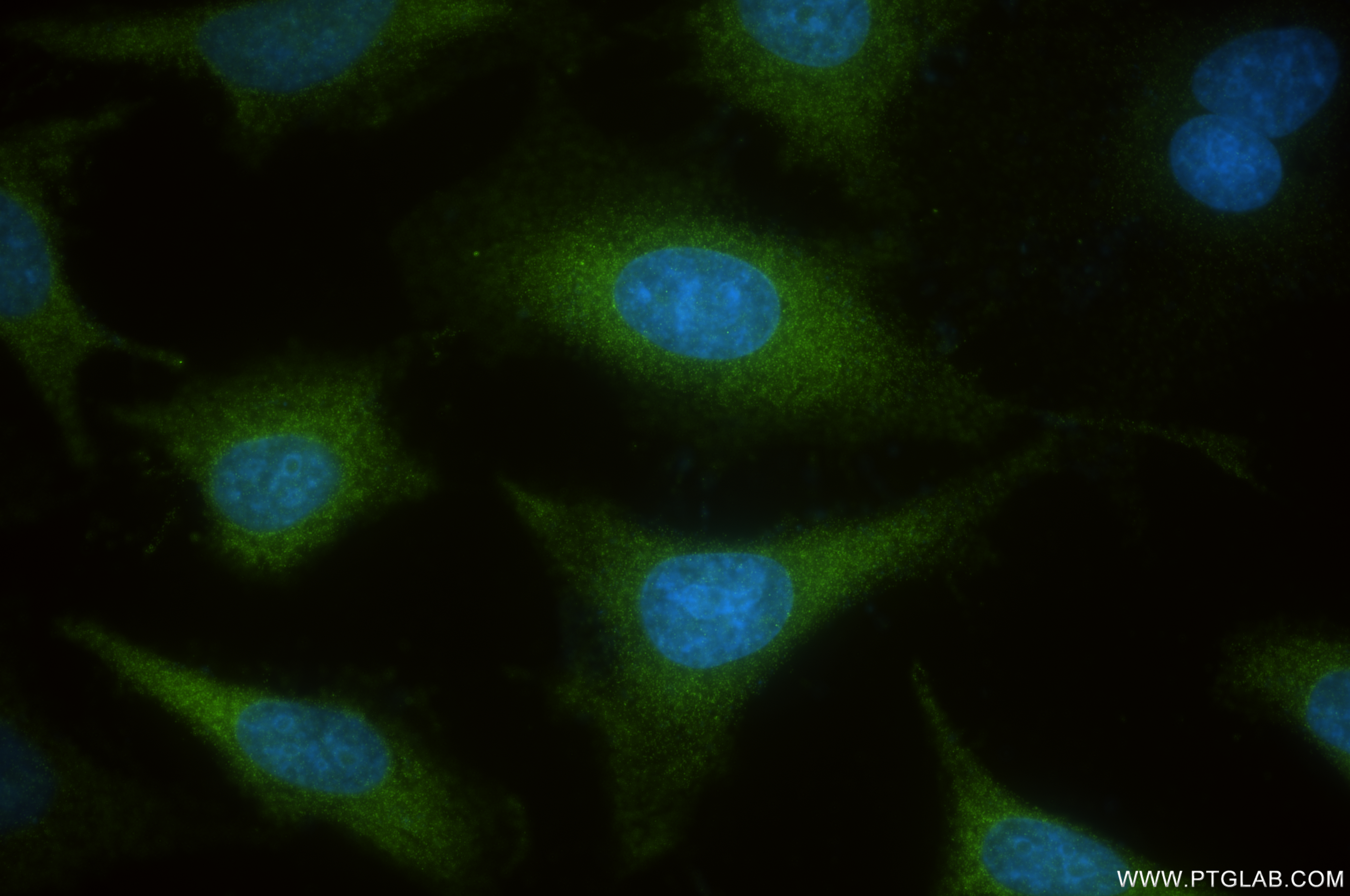 IF Staining of HeLa using 83986-5-RR