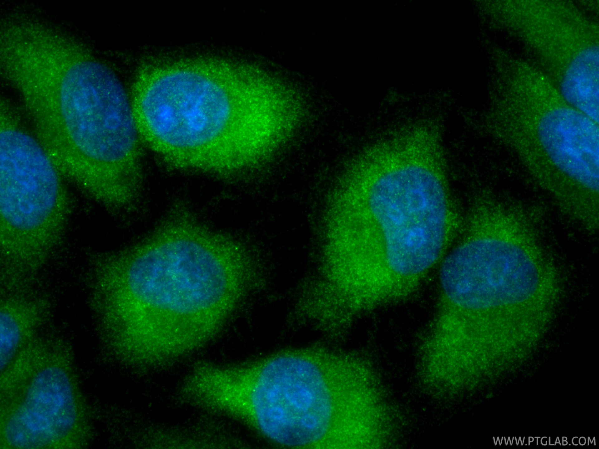 Immunofluorescent analysis of (-20°C Ethanol) fixed HepG2 cells using NMI antibody (<a class='green' href='/productredirect?CatalogNo=83986-5-RR' target='_blank'>83986-5-RR</a>, Clone: 241135H2 ) at dilution of 1:400 and CoraLite®488-Conjugated Goat Anti-Rabbit IgG(H+L) (<a class='green' href='/productredirect?CatalogNo=SA00013-2' target='_blank'>SA00013-2</a>). This data was developed using the same antibody clone with 83986-5-PBS in a different storage buffer formulation. IF Staining of HepG2 using 83986-5-RR (same clone as 83986-5-PBS)