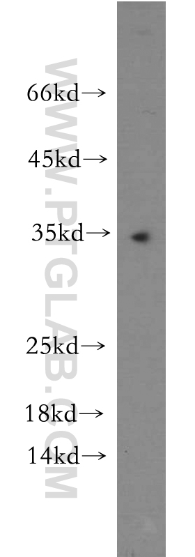 WB analysis of human testis using 11399-1-AP