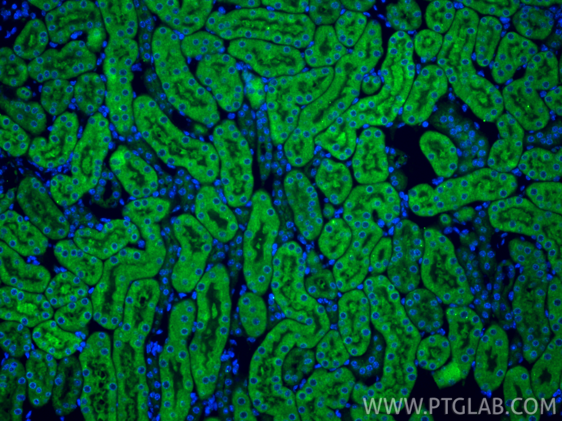 Immunofluorescent analysis of (4% PFA) fixed paraffin-embedded mouse kidney tissue using NMNAT3 antibody (13236-1-AP) at dilution of 1:200 and CoraLite®488-Conjugated Goat Anti-Rabbit IgG(H+L) (<a class='green' href='/productredirect?CatalogNo=SA00013-2' target='_blank'>SA00013-2</a>). Heat mediated antigen retrieval with Tris-EDTA buffer (pH 9.0). IF Staining of mouse kidney using 13236-1-AP