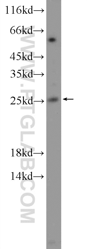 NMNAT3 Polyclonal antibody