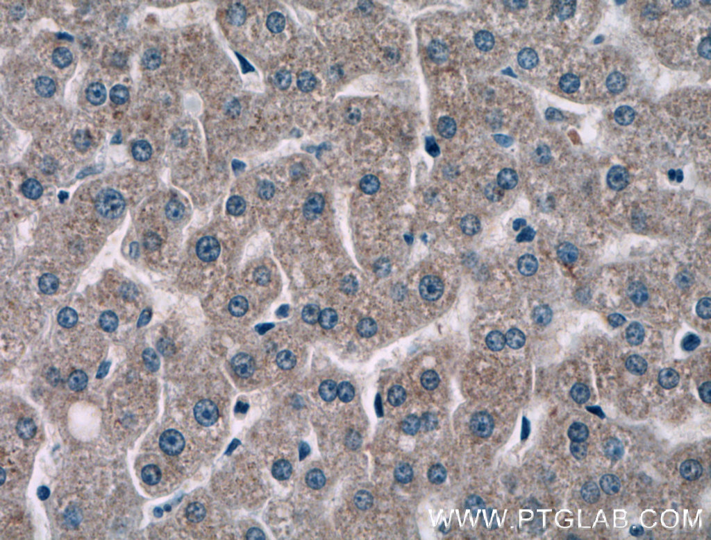 IHC staining of human liver using 15765-1-AP