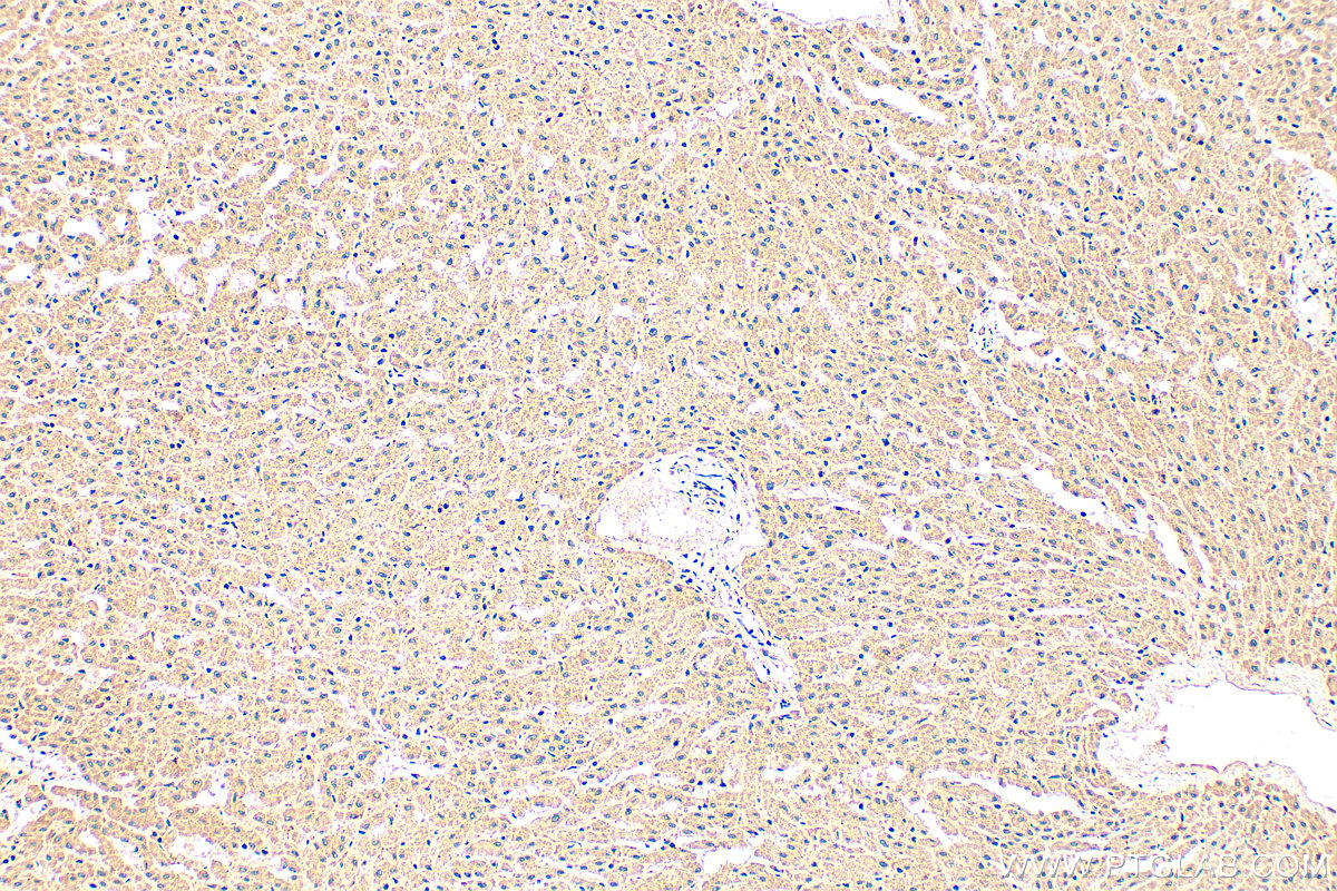 Immunohistochemical analysis of paraffin-embedded human liver tissue slide using 15765-1-AP (NMRAL1 antibody) at dilution of 1:200 (under 10x lens). Heat mediated antigen retrieval with Tris-EDTA buffer (pH 9.0). IHC staining of human liver using 15765-1-AP