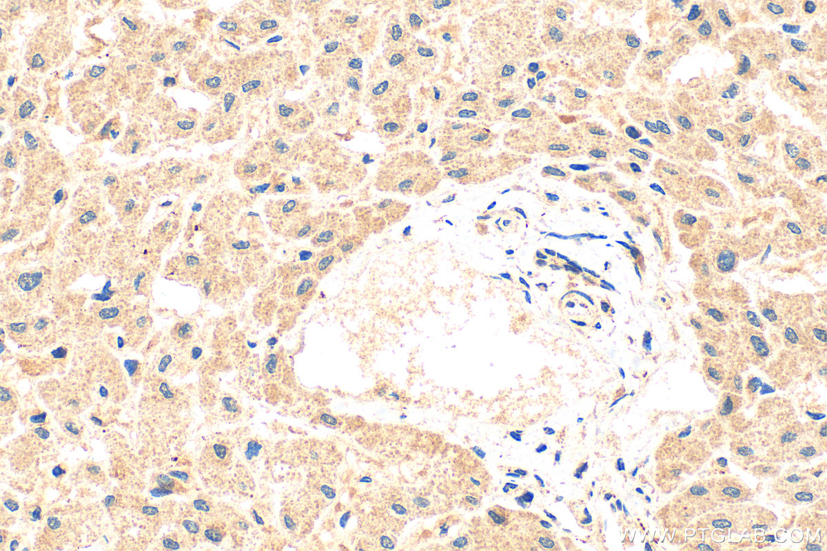 Immunohistochemical analysis of paraffin-embedded human liver tissue slide using 15765-1-AP (NMRAL1 antibody) at dilution of 1:200 (under 40x lens). Heat mediated antigen retrieval with Tris-EDTA buffer (pH 9.0). IHC staining of human liver using 15765-1-AP