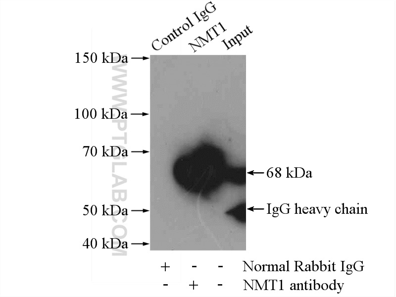 IP experiment of HeLa using 11546-1-AP