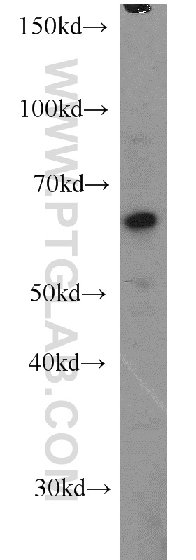 WB analysis of SKOV-3 using 11546-1-AP